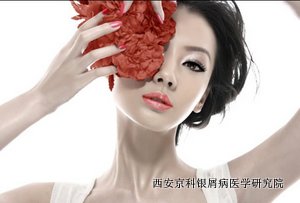 牛皮癣女性经期如何护理